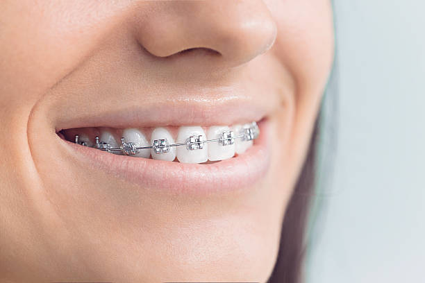 Best Invisalign and Clear Aligners  in Ansonia, OH